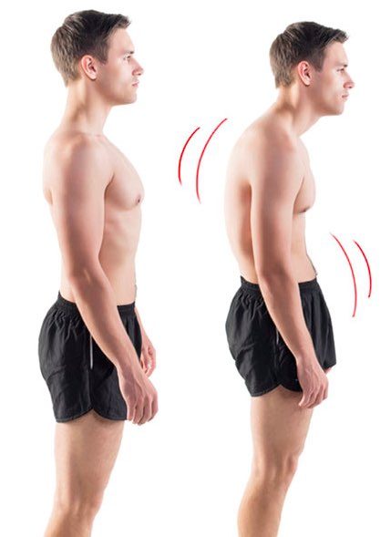 Do you have a forward head posture